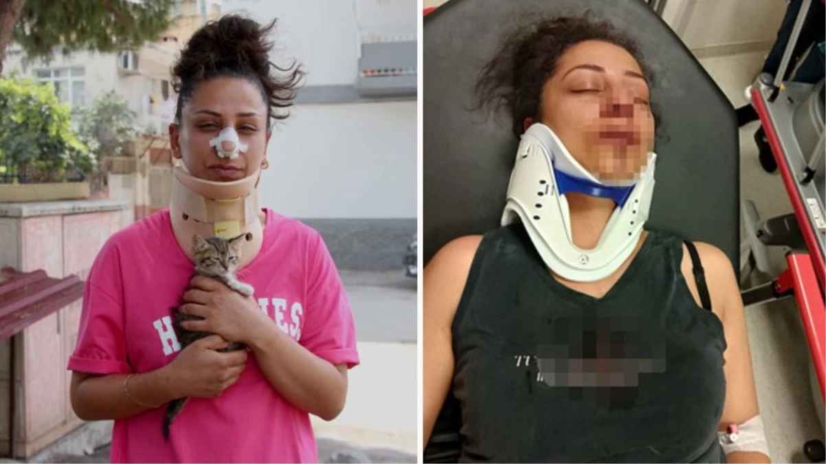 Pitbull köpeklerini sokak kedilerinin üzerine saldı, karşı çıkan komşusunun burnunu kırdı