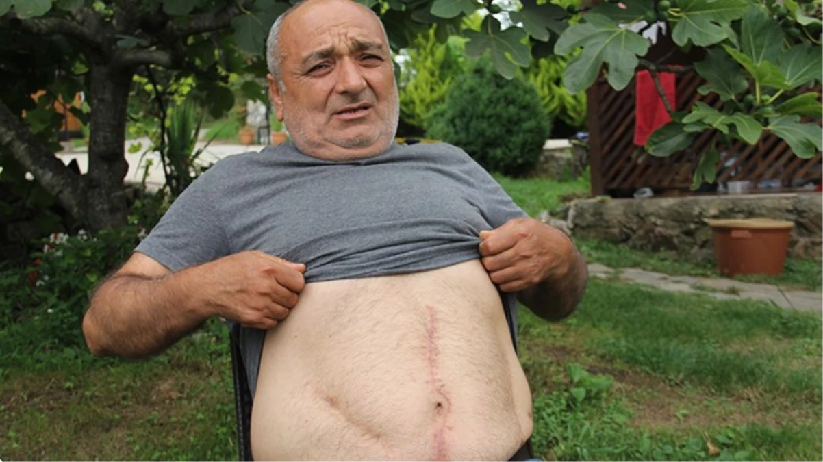 Geçirdiği ameliyatta karnından 3 parça gazlı bez unutuldu! Gerçeği 18 yıl sonra öğrendi