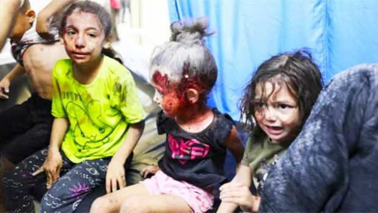 Gazze’de ameliyatlar anestezisiz yapılıyor: Ya bu acıyı çekecekler ya da ölecekler