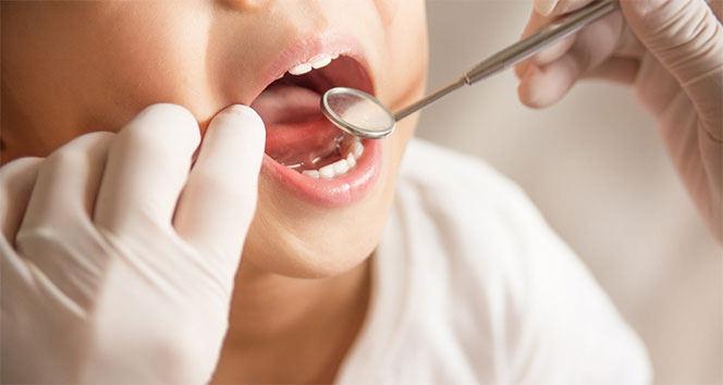 Sağlık için ciddi tehlike: Diş çürüğünü hafife almayın