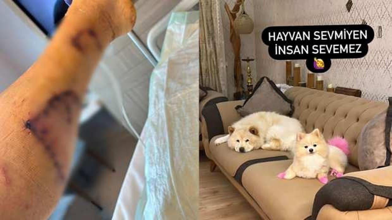 Evdeki diğer köpekten sahibini kıskanarak bacağını parçaladı