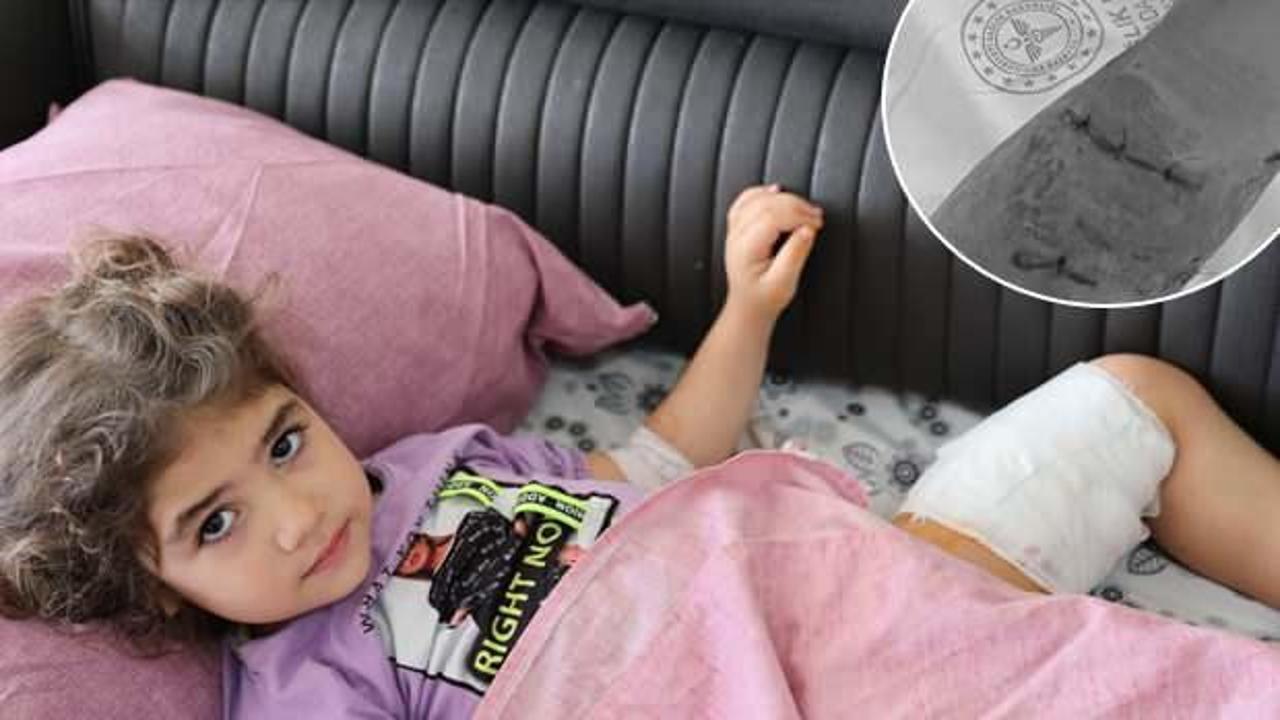 Köpeğin ısırdığı minik Asel korku dolu anları anlattı: Köpek de sahibi de tutuklansın