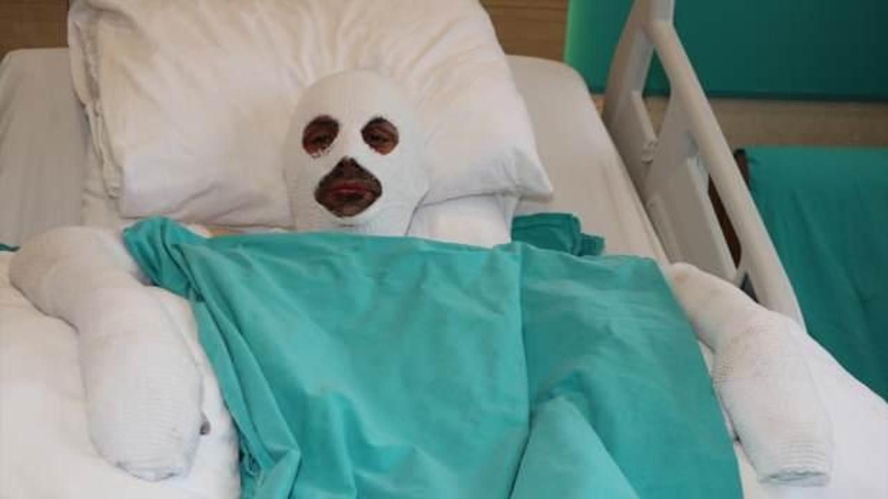 Bir anlık dalgınlığın sonucu ağır oldu! Açık unuttuğu gaz hastanelik etti