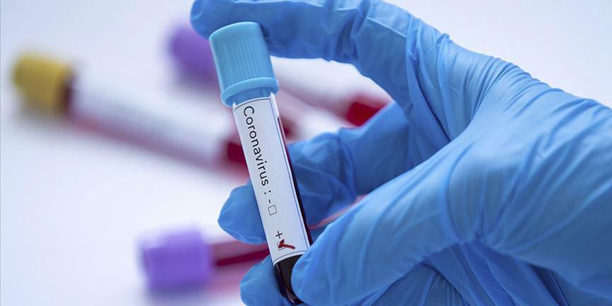 İlaç devi AstraZeneca yan etkileri nedeniyle Covid-19 aşısını küresel çapta geri çekti